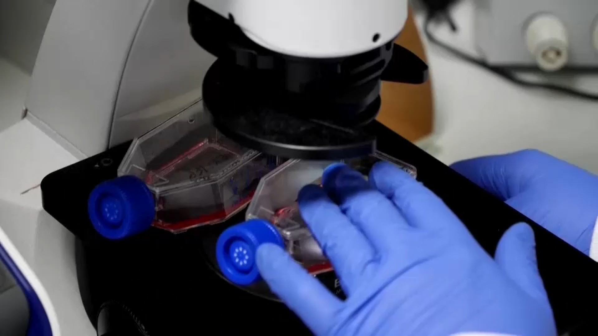 Source-feed image associated with Study shows a blood test can help identify healthy people at high risk for Alzheimer's disease