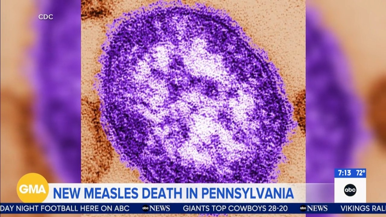 Source-feed image associated with Another measles-related death reported in Pennsylvania as outbreak grows