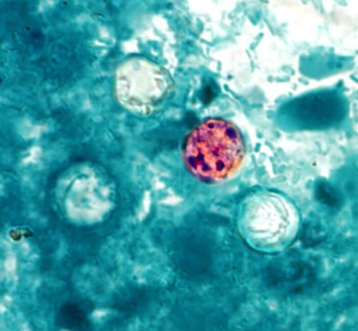Source-feed image associated with FDA reports new outbreak of explosive diarrhea with 72 cases identified