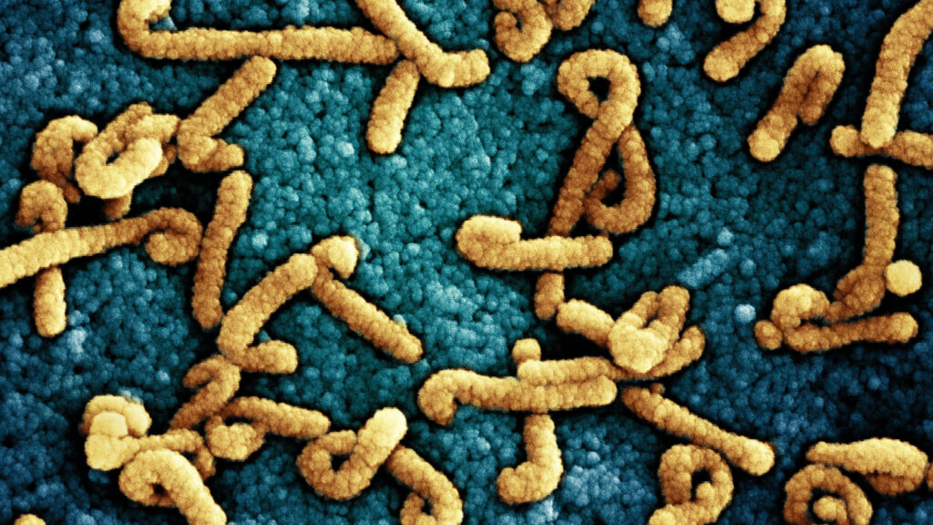 Source-feed image associated with Marburg outbreak is reported in Uganda, threatening to complicate Ebola response in region