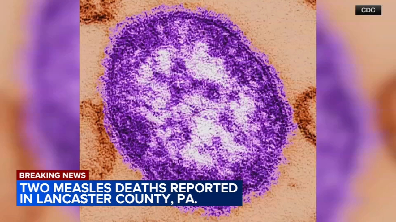 Source-feed image associated with 2 die from measles in Lancaster County, Pennsylvania, health officials say