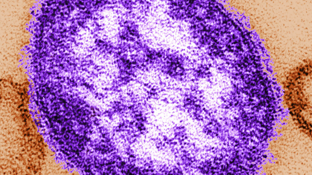 Source-feed image associated with Coroner releases details of infants who died amid growing Pennsylvania measles outbreak