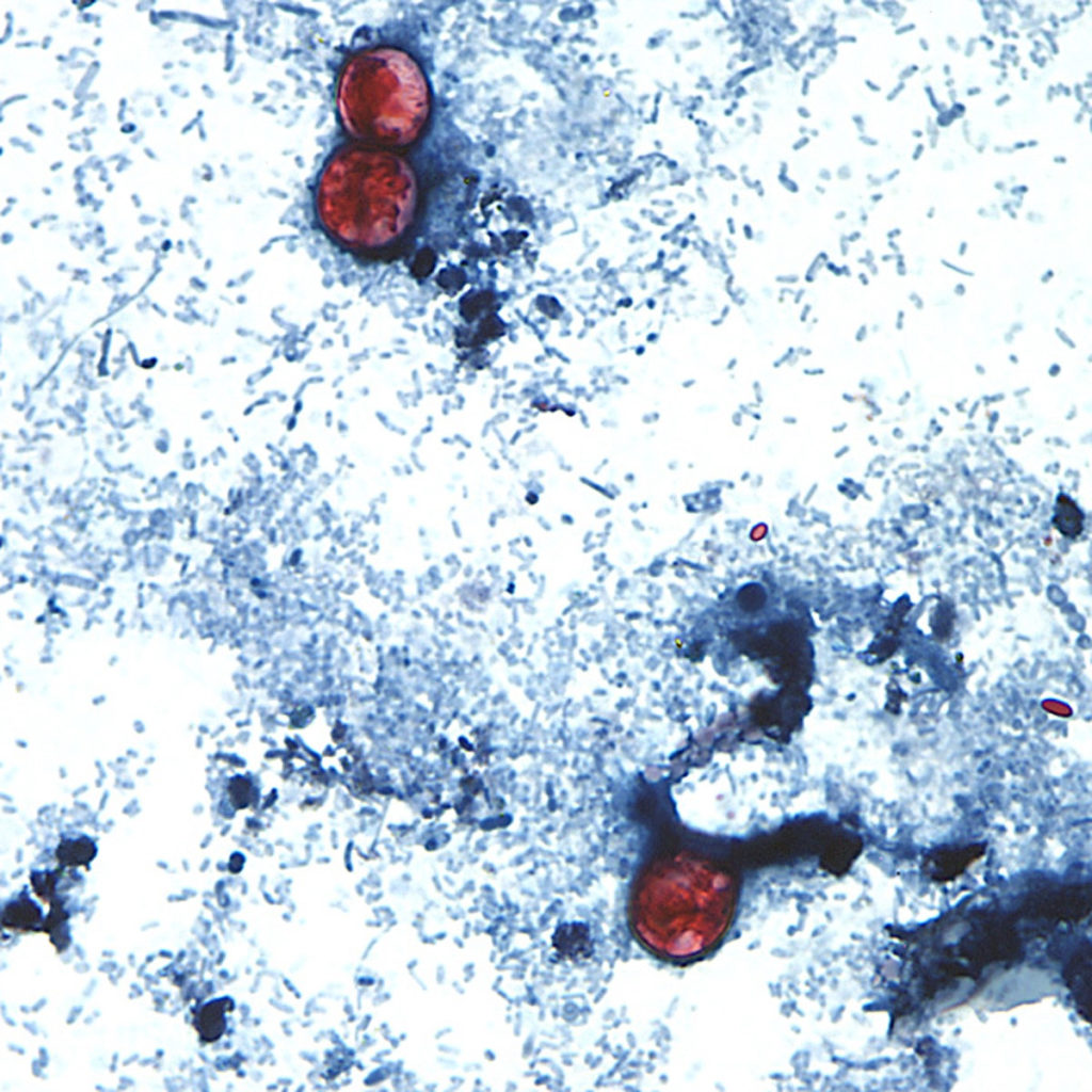 Source-feed image associated with What we know about the cyclosporiasis outbreak linked to produce