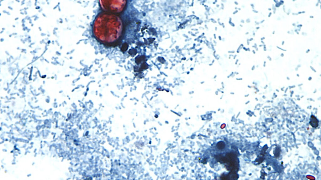 Source-feed image associated with Michigan reports the first 2 U.S. deaths related to a diarrhea-causing parasite