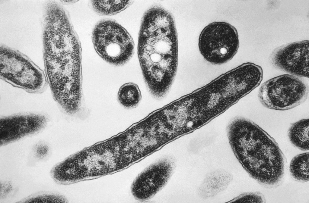 Source-feed image associated with Second death reported in Legionnaires' disease outbreak in New York City