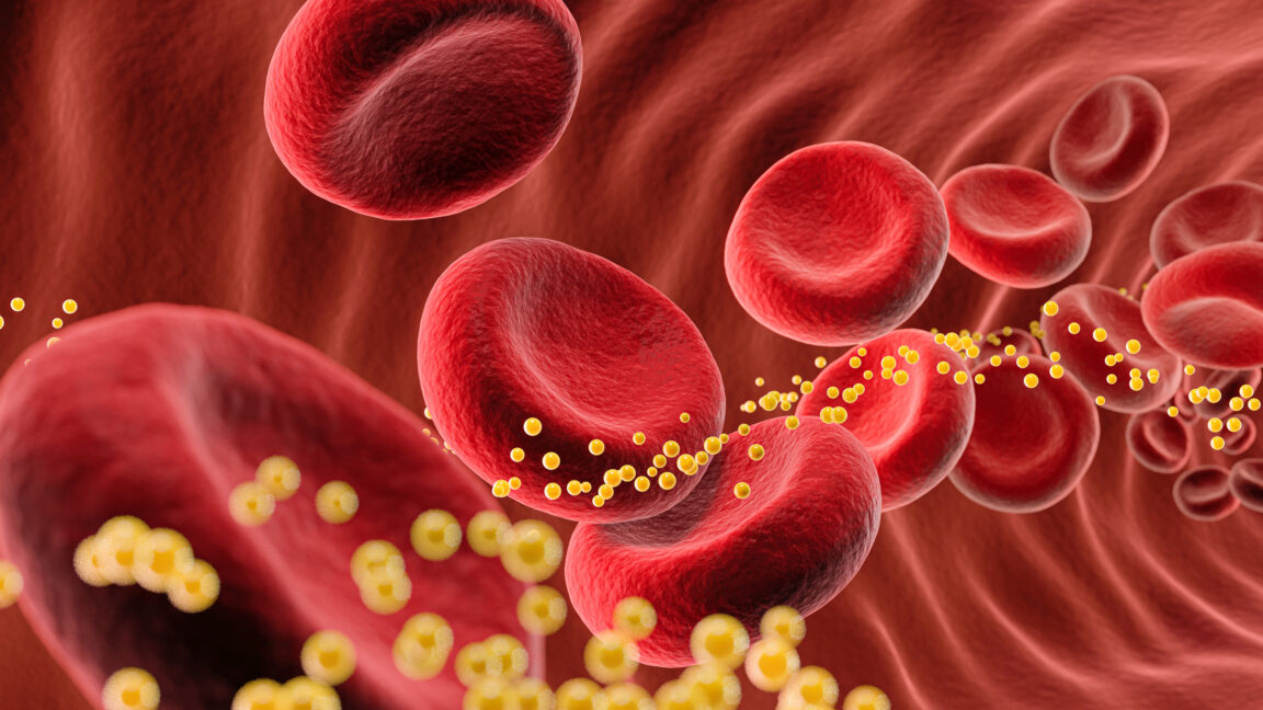 Source-feed image associated with Bad cholesterol slashed 62% by single dose of gene-editing drug in small trial