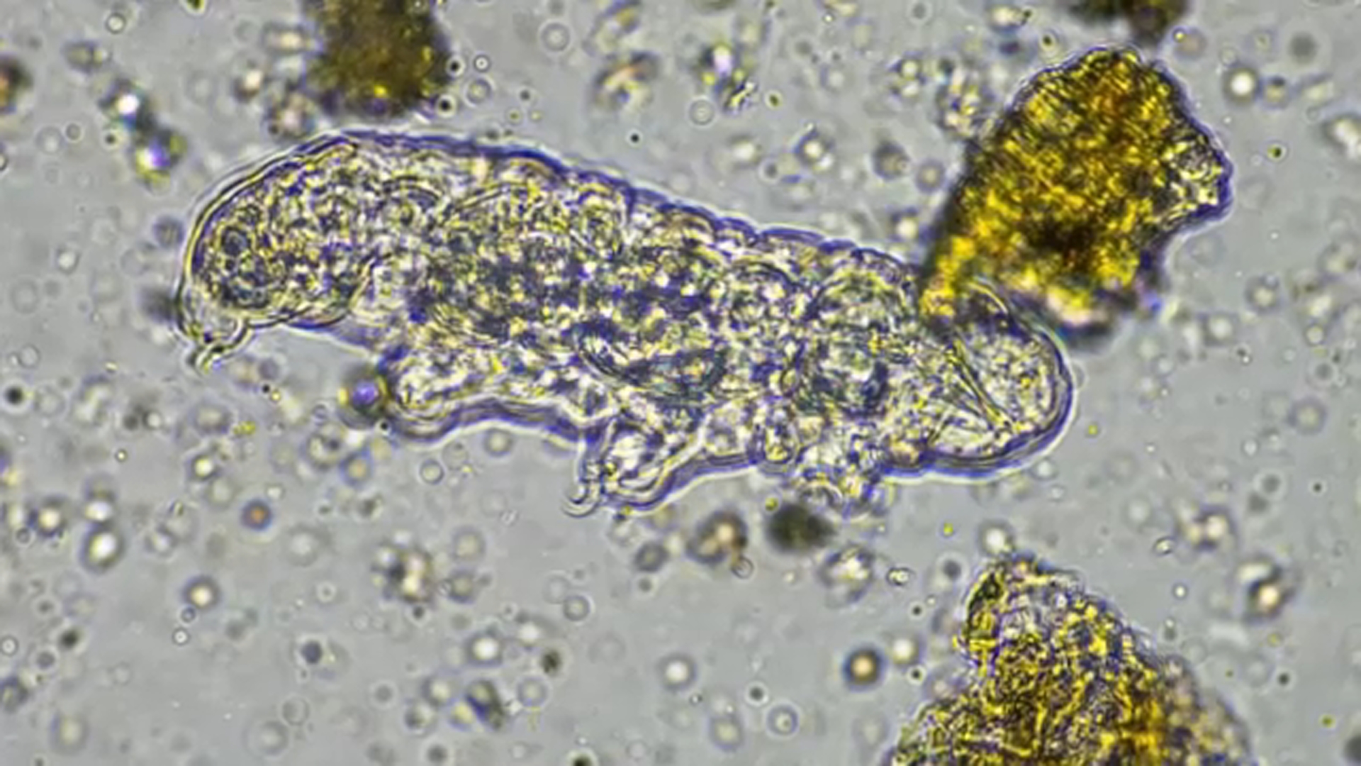 Source-feed image associated with North Carolina teen dies from rare brain-eating amoeba found in freshwater: Health officials