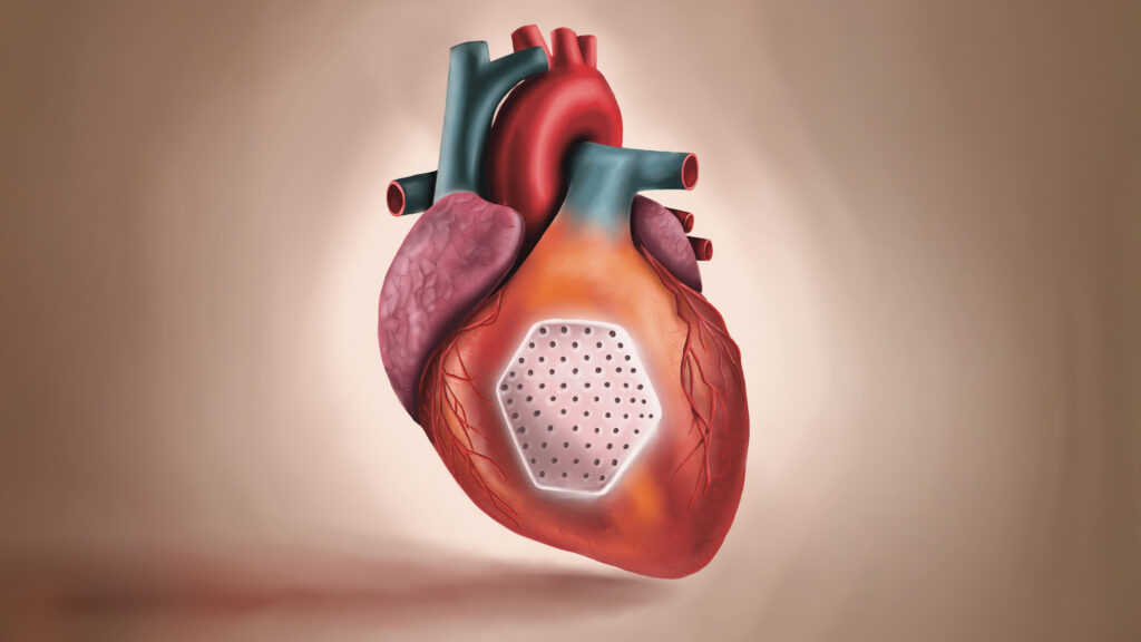 Source-feed image associated with STAT+: Heart patch engineered from stem cells revved up weakened hearts