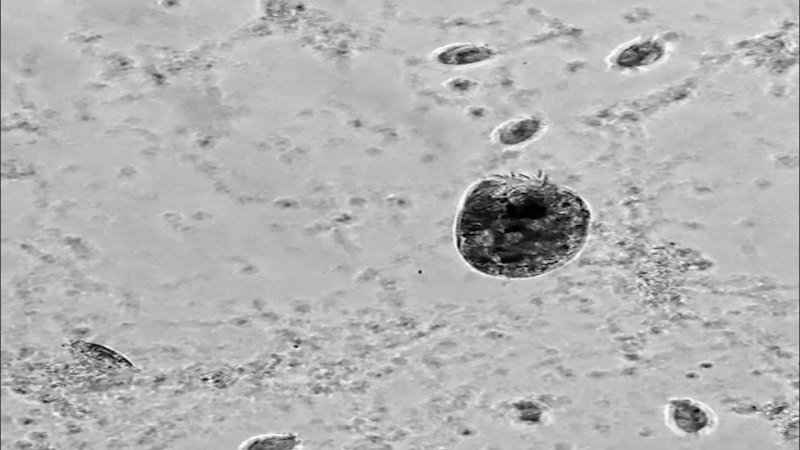 Source-feed image associated with This microbe turns into a cannibalistic ‘Hulk’