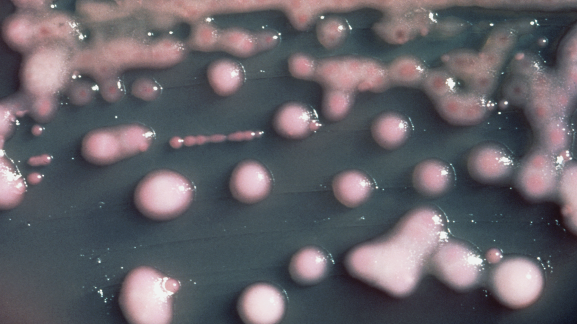 Source-feed image associated with A woman got a UTI. Two years later, the bacteria had evolved, invaded her brain.