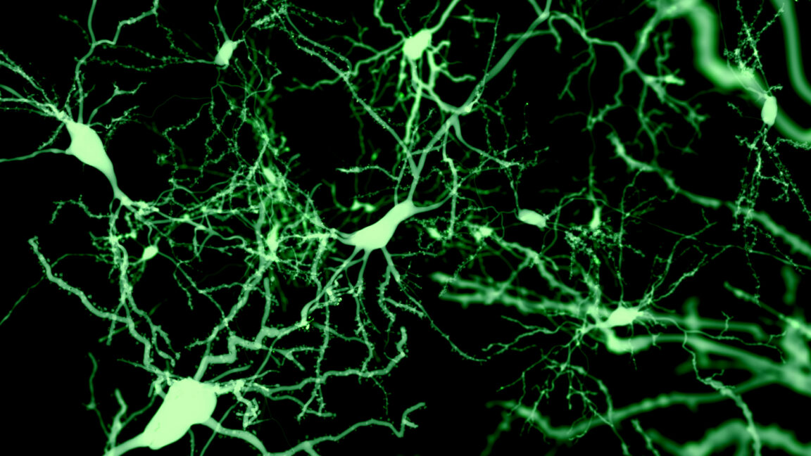 Source-feed image associated with Finding the cells that put our brain to sleep