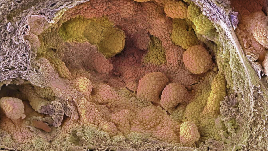 Source-feed image associated with STAT+: For prostate cancer patients set on surgery, new hormone regimen may improve outcomes, study finds