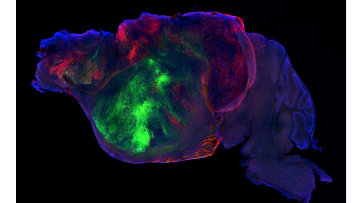 Source-feed image associated with Researchers swap in human brain cells for a mouse's cortex
