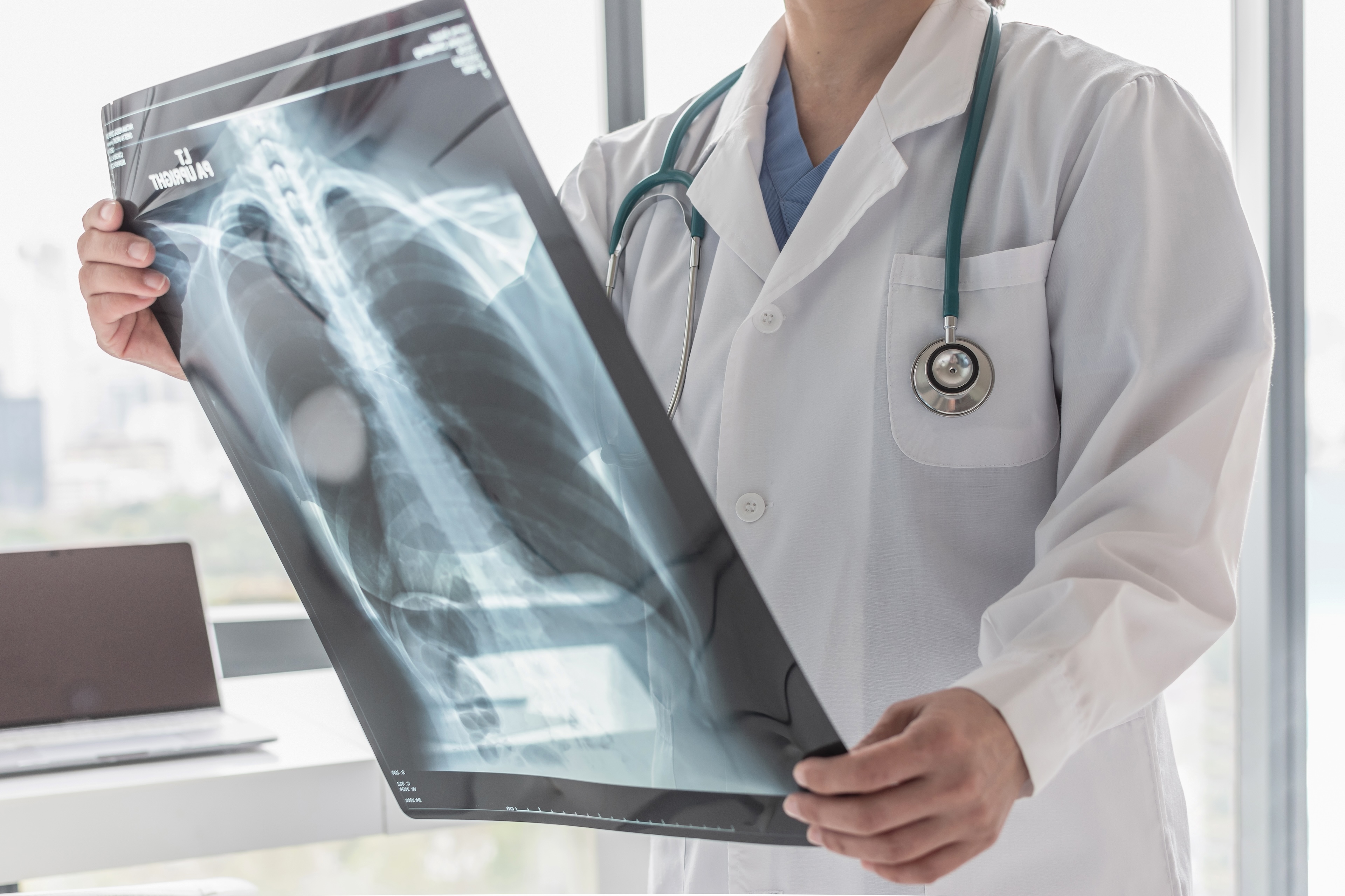 Source-feed image associated with Years After He Quit Smoking, a Lung Cancer Scan Saved His Life