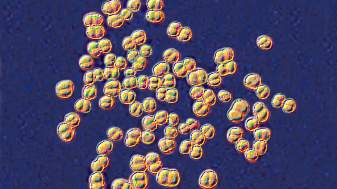 Source-feed image associated with College lab class ends with 32 people on antibiotics for deadly germ exposure