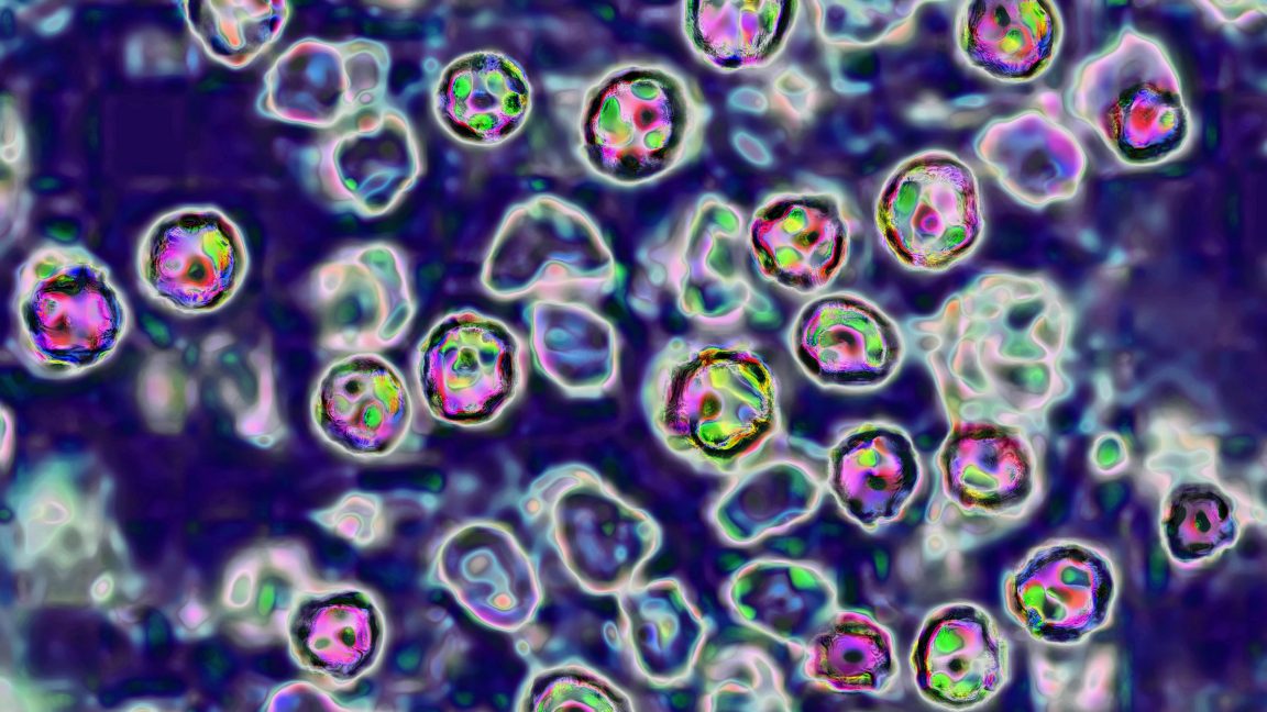 Source-feed image associated with Unvaccinated Pennsylvania woman died of measles complications, coroner says