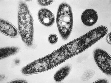Source-feed image associated with New cases slow in NYC Legionnaires' disease outbreak; Met museum among buildings with positive tests