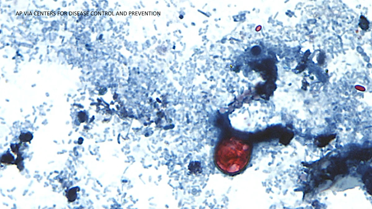 Source-feed image associated with Outbreak of diarrhea caused by cyclosporiasis spreading in US with cases reported in CA, CDC says