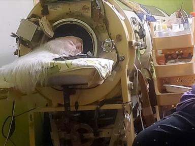Source-feed image associated with Martha Lillard, last US polio patient using iron lung, dies at 78 in Oklahoma