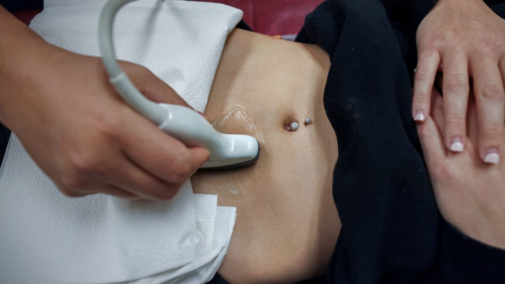 Source-feed image associated with Why doctors say abortion bans are worsening medical care during miscarriages