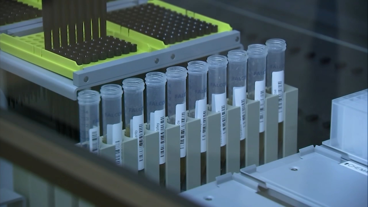 Source-feed image associated with Rotavirus levels rising across Bay Area: Here's how it spreads, who's most at risk