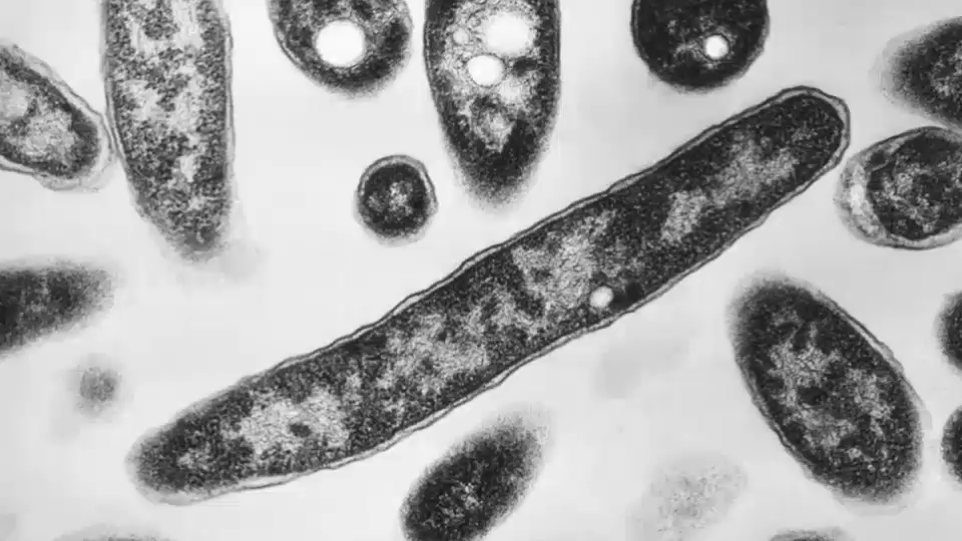 Source-feed image associated with Second death reported in Legionnaires' disease outbreak in New York City