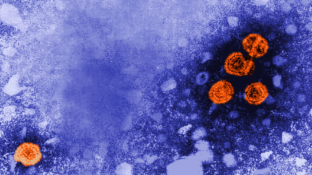 Source-feed image associated with STAT+: Experimental hepatitis B treatment was a ‘functional cure’ for nearly 1 in 5, new data show