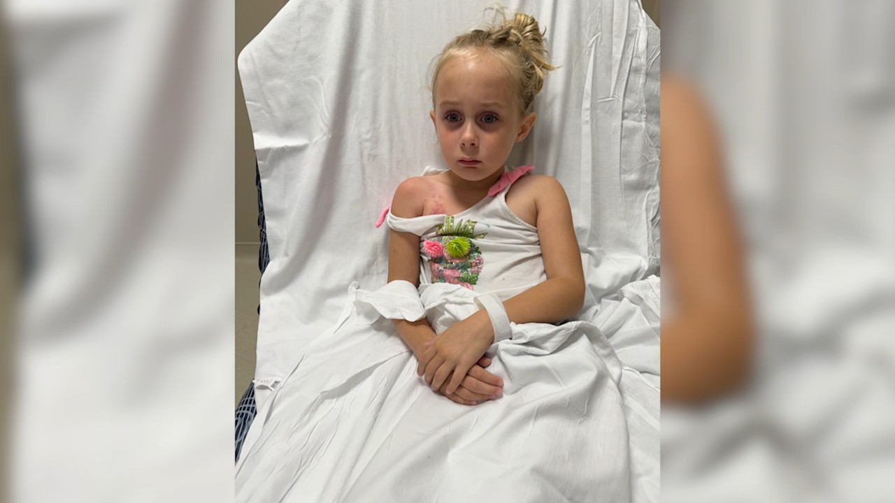Source-feed image associated with 6-year-old stung by invasive clinging jellyfish in New Jersey's Metedeconk River
