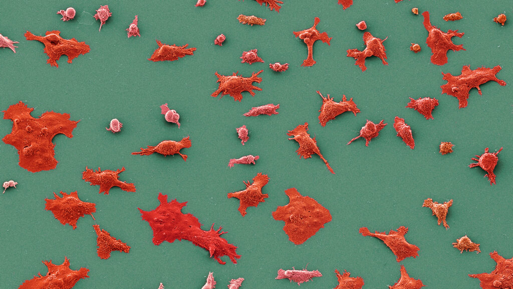Source-feed image associated with STAT+: Practice-changing results reported for Revolution Medicines pancreatic cancer drug