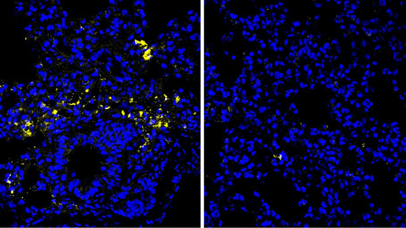 Source-feed image associated with How one amino acid might help fight colon cancer and infections