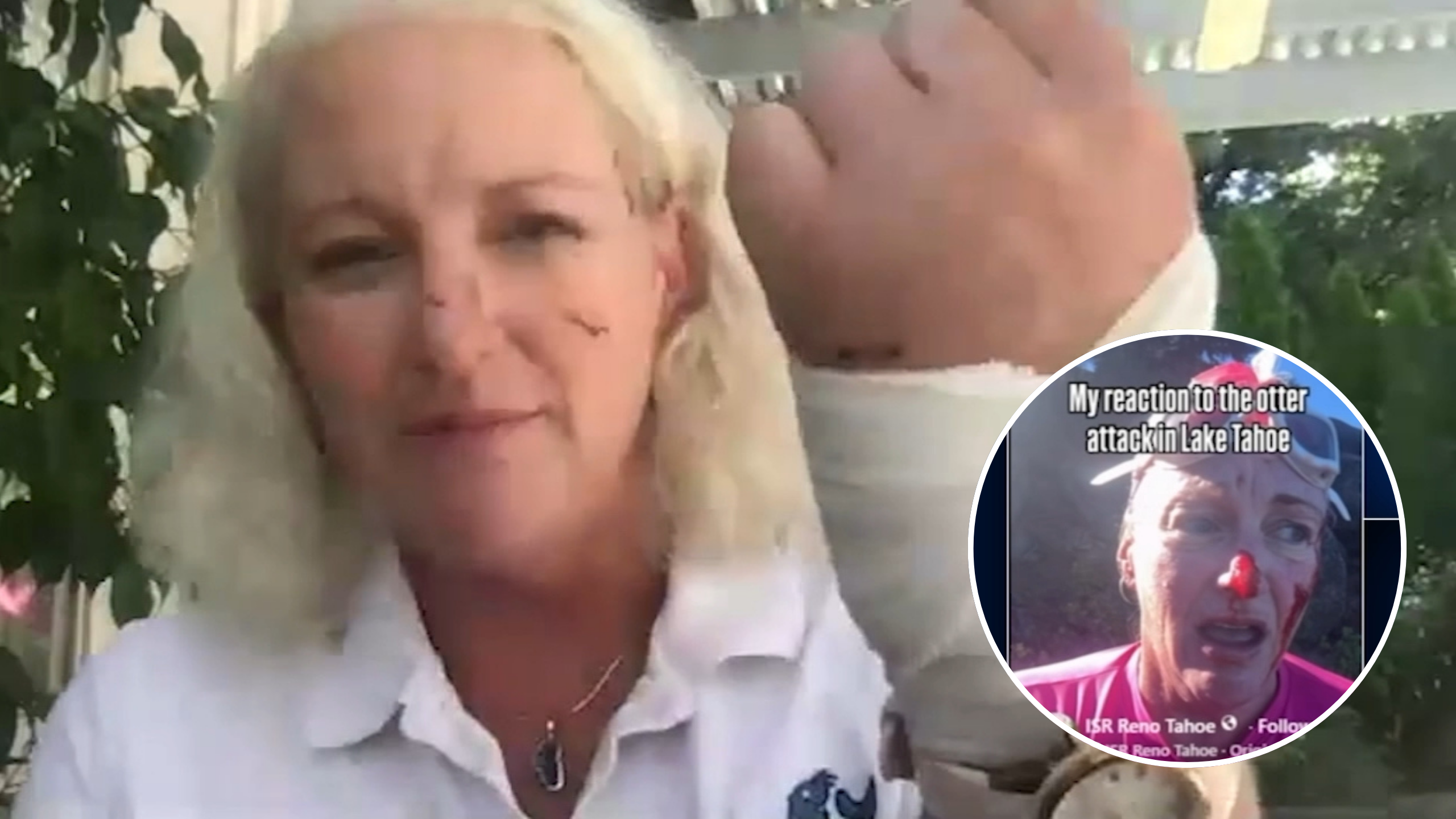 Source-feed image associated with Lake Tahoe swim instructor recounts rare river otter attack, receiving 38 stitches