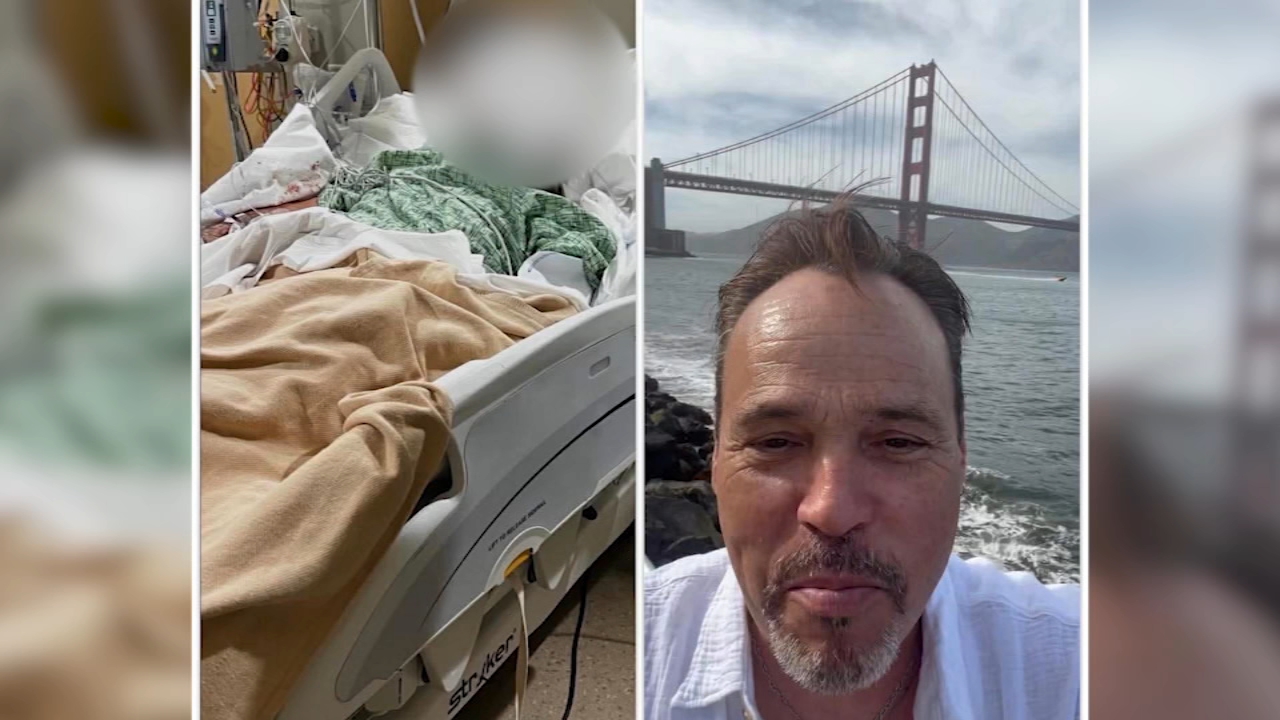 Source-feed image associated with No arrests 2 months after Oakland hit-and-run that left man in coma with broken skull